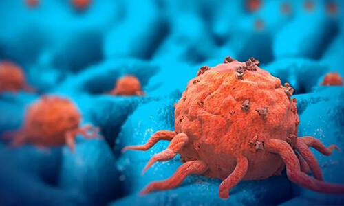 癌症干细胞