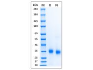 Recombinant Human SARS-CoV-2 Spike Protein RBD