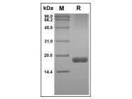 Recombinant Human TRAIL R2/TNFRSF10B Protein(Active)